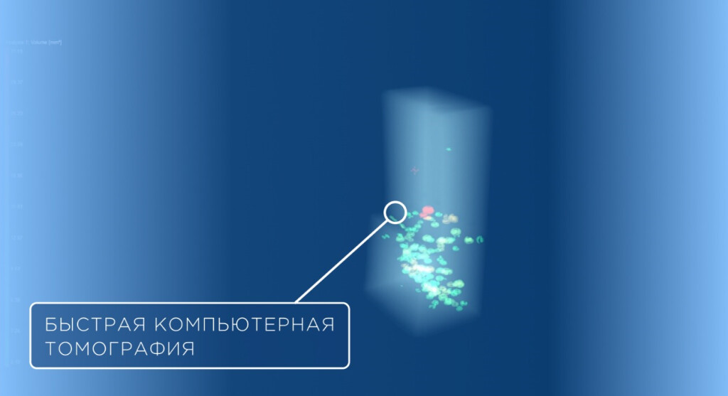 Быстрая компьютерная томография: почему современное 3D-исследование занимает минуты вместо часов